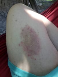 Itrosted- TF Cream (Indian) - শক্তিশালী অ্যান্টিফাঙ্গাল_img_4