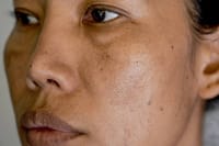 Luk Lit Cream[Indian]- মেছতা ও দাগের চিকিৎসায়_img_3