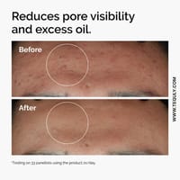 The Ordinary Niacinamide 10% + Zinc 1%_img_3