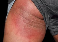 Luliact Soap 75 gm [Indian] দাদ ছুলি দূর করার সাবান_img_7