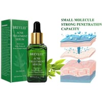 Breylee Acne Treatment Serum_img_0