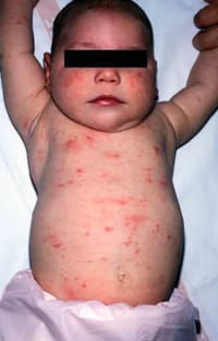 Scrabic Soap [Indian]_img_10