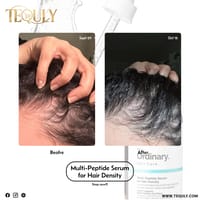 The Ordinary Multi-Peptide Serum for Hair Density 60ml_img_2