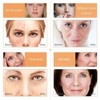 Melao Naturals Vitamin C Facial Serum with Vitamin C 20% E & Hyaluronic Acid_img_4