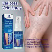 OUHOE Varicose Veins Spray._img_3