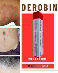 Derobin Ointment 30 gm [Indian]_img_0