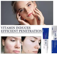 Lion Pair Medicated Acne Care Cream 14g_img_3