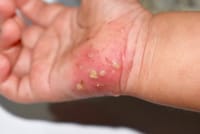 Scrabic Lotion [Indian] শিশুদের জন্য_img_5