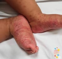 Scrabic Lotion [Indian] শিশুদের জন্য_img_4