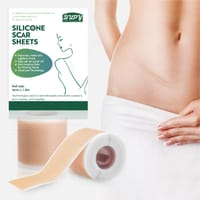 Silicone Gel Scar Patch Roll – Adjustable, Effective Scar Treatment_img_0
