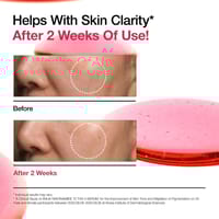 Anua Niacinamide 10% + TXA 4% Dark Spot Correcting Serum – 30ml_img_2