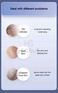 💥HEGRUS Rechargeable Electric Foot Grinder with 2 Grinding Heads_img_3