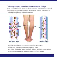 OUHOE Varicose Veins Spray._img_2