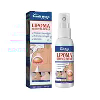 South Moon - Lipoma Remover Spray Relief Lipolysis Fat Lump With Lipoma Spray 50 ml_img_1
