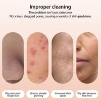 Electric Face Suction Removal Machine Men & Women Pore Cleaner black Head Vacuum Pimple Black Head Remover Beauty Device_img_2