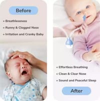 বেবি নোজ ক্লিনার, নাক চোষার টুল, বেবি নাসাল অ্যাসপিরেটর ইনফ্যান্ট, পুনঃব্যবহারযোগ্য নিরাপদ নাক সাকশন নবজাতকের স্বাস্থ্য যত্ন শিশুর যত্নের সরঞ্জাম_img_4