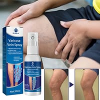 OUHOE Varicose Veins Spray._img_4