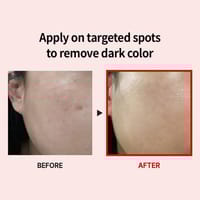 Medi-Peel Melanon X Cream - 30ml_img_2