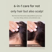 𝐂𝐀𝐑𝐄:𝐍𝐄𝐋 𝐇𝐢𝐠𝐡 𝐈𝐧𝐭𝐞𝐧𝐬𝐢𝐭𝐲 𝐀𝐧𝐭𝐢 𝐇𝐚𝐢𝐫 𝐋𝐨𝐬𝐬 𝐒𝐜𝐚𝐥𝐩 𝐓𝐨𝐧𝐢𝐜 (𝟏𝟓𝟎𝐦𝐥)_img_3