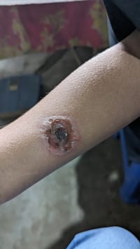 Chandani - G [স্টেরয়েডযুক্ত শক্তিশালী ক্রিম ]_img_4