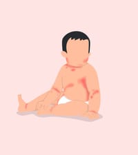 Permimite Lotion [Indian] চুলকানি ধ্বংসকারী এবং উকুননাশক_img_7