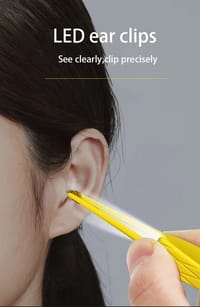 BABY EAR WAX CLEANING TOOLS SET_img_2