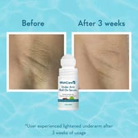 WishCare Underarm Roll On Serum - 5% AHA & 3% Kojic for Brightening & Odour Control - Roll On Deo for Women & Men- Long Lasting Aqua Fragrance - 50ml_img_1