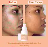 WishCare Super Bright C16 Vitamin C Serum 30ml_img_2