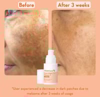 WishCare Super Bright C16 Vitamin C Serum 30ml_img_3