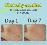 Chemist at Play 10% Vitamin C Face Serum 30ml_img_2