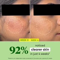 Dot & Key Cica + Niacinamide Oil Free Moisturizer - 15ml_img_2