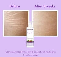 WishCare Collagen Retinol Body Lotion 200ml_img_4