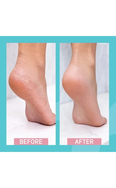 Siodil Daily Cracked Heels Cream 40 ml - Image 6