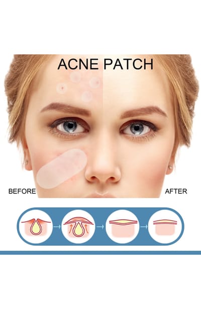 Earth Beauty & You Cica care+ Barrier Repair Acne Treatment Serum - Image 3