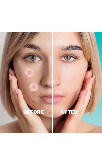 Earth Beauty & You Cica care+ Barrier Repair Acne Treatment Serum - Image 4