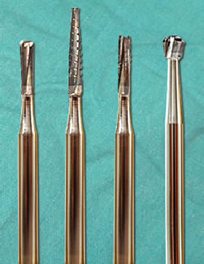 Access Opening BUR (Japan)