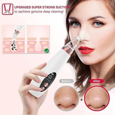 Rechargeable electric blackhead remover machine