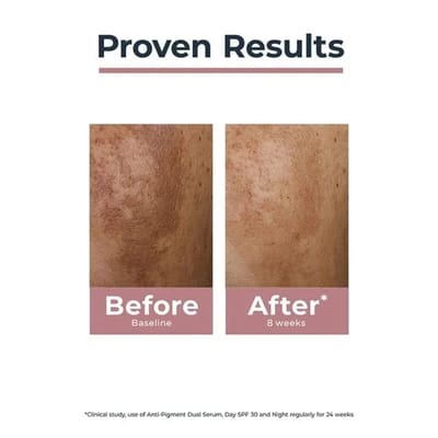 Eucerin Spotless Brightening Boosting Essence - Image 3