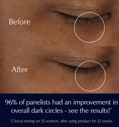 Estee Lauder Advanced Night Repair Eye Supercharged Gel-Creme Synchronized Multi-Recovery Eye Cream, 15ml - Image 4