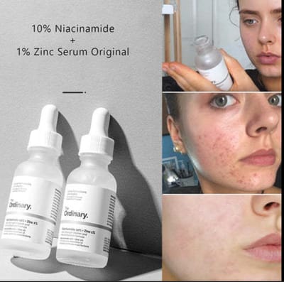 The Ordinary Niacinamide 10% + Zinc 1% Oil Control Serum - Image 3