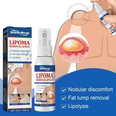 South Moon - Lipoma Remover Spray Relief Lipolysis Fat Lump With Lipoma Spray 50 ml
