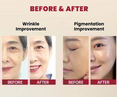 KSECRET - SEOUL 1988 Serum : Retinal Liposome 2% + Black Ginseng - Image 4