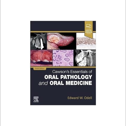 Cawson's Essentials of Oral Pathology and Oral Medicine