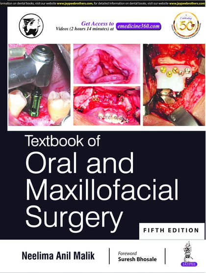 Textbook of Oral and Maxillofacial Surgery by Neelima Anil Malik