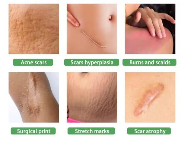 Ouhoe Scar Removal Serum 30 ml