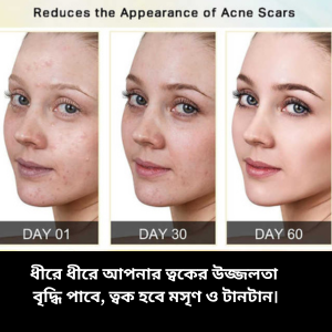 Mountain Honey Soa_img_4