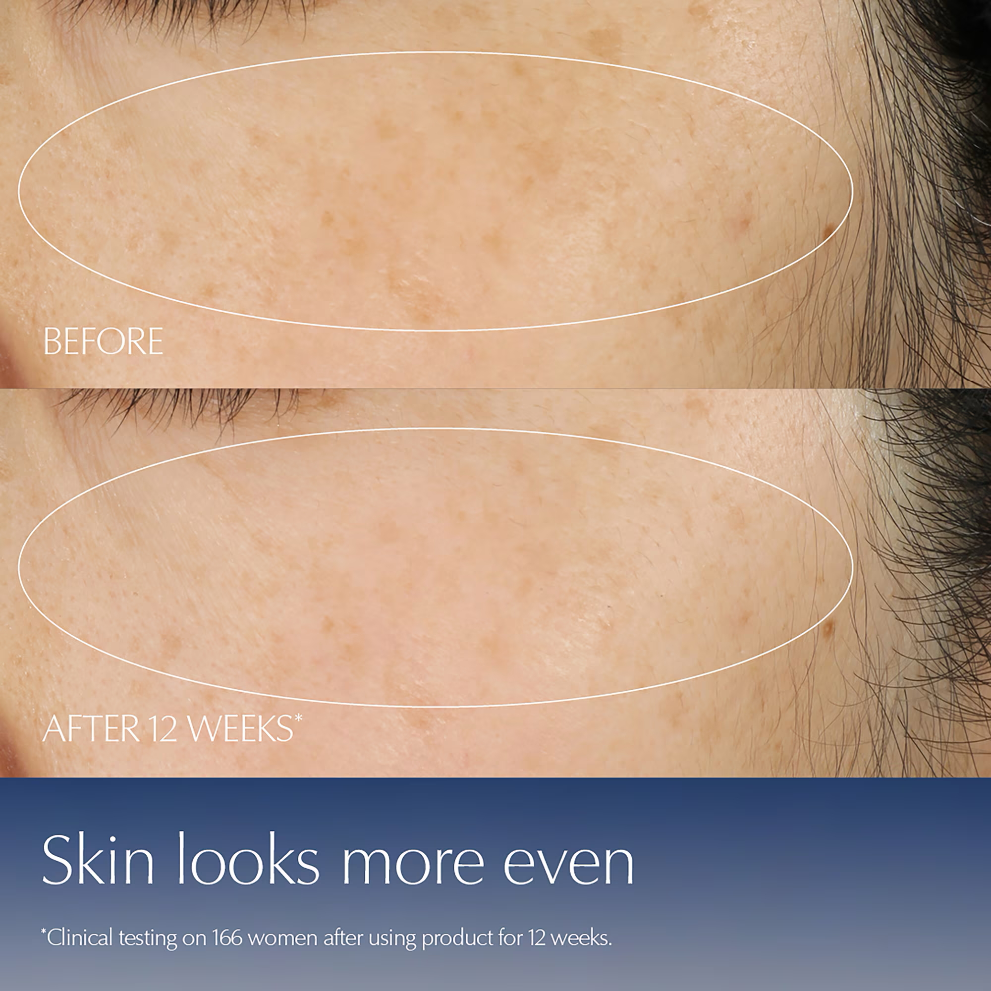 ESTÉE LAUDER – Advanced Night Repair Synchronized Multi-Recovery Complex_img_5